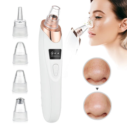 Electric Facial Skin Care Pore Removal Cleanser Vacuum Acne Removal For Deep Facial Pores 5 Suction Power Blackhead Remover Pore