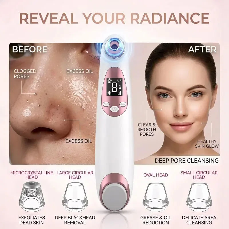 Multi-functional Blackhead Remover Pore Vacuum with Cold Compress, Facial Cleanser Pore Minimizer Beauty Device for Acne & Black