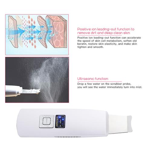 Ultrasonic Skin Scrubber Facial Cleanser – Blackhead & Acne Remover, Deep Pore Cleansing Face Spatula, Exfoliation & Skin Lifting Beauty Device