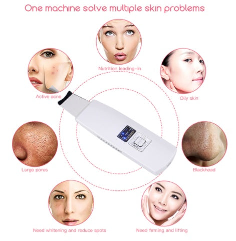 Ultrasonic Skin Scrubber Facial Cleanser – Blackhead & Acne Remover, Deep Pore Cleansing Face Spatula, Exfoliation & Skin Lifting Beauty Device