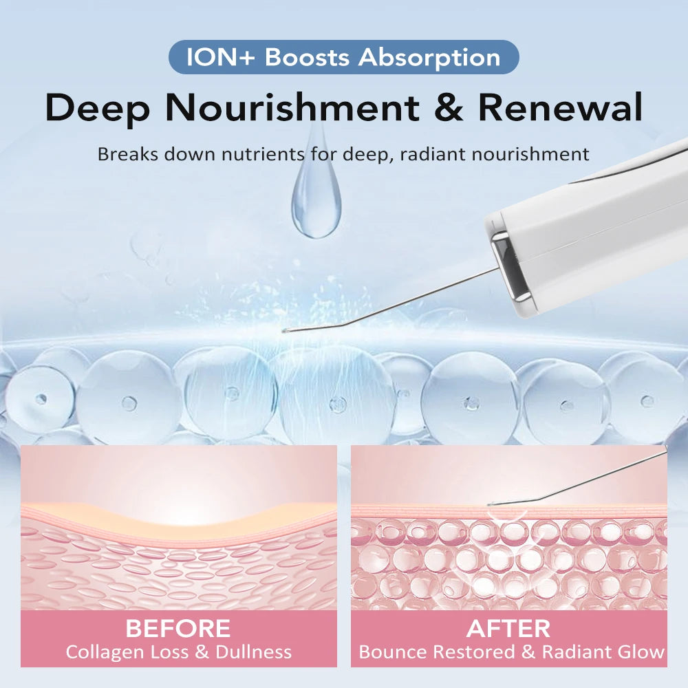 Ultrasonic Skin Scrubber Deep Face Cleaning Acne Blackhead Remover Facial Spatula Peeling Shovel EMS Skin Lifting Machine