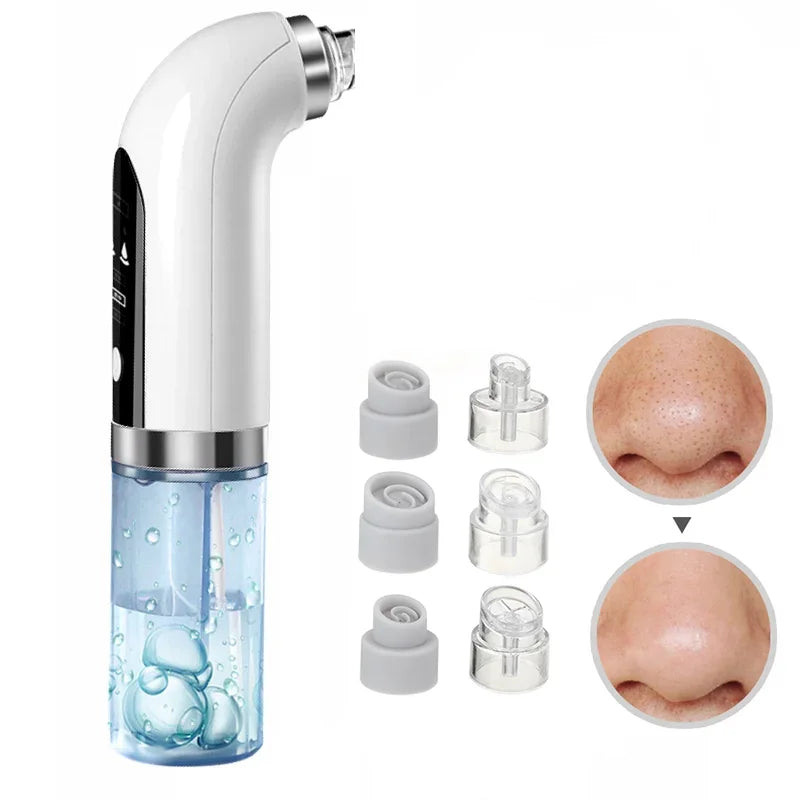 Electric Blackhead Removal Pore Vacuuming Facial Cleanser Acne Removal Blackhead Usb Rechargeable Water Circulation Cleaning Too