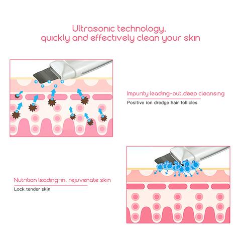 Ultrasonic Skin Scrubber Facial Cleanser – Blackhead & Acne Remover, Deep Pore Cleansing Face Spatula, Exfoliation & Skin Lifting Beauty Device