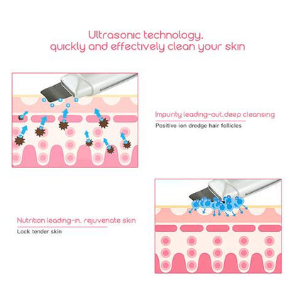 Ultrasonic Skin Scrubber Facial Cleanser – Blackhead & Acne Remover, Deep Pore Cleansing Face Spatula, Exfoliation & Skin Lifting Beauty Device