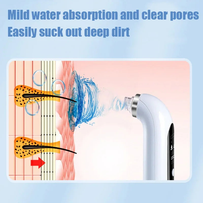 Electric Blackhead Removal Pore Vacuuming Facial Cleanser Acne Removal Blackhead Usb Rechargeable Water Circulation Cleaning Too