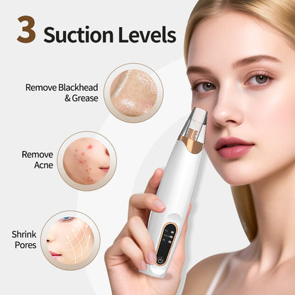 Electric Blackhead Vacuum Remover Vacuum Facial Pore Cleaner Acne Extractor Tool Nose Cleaner Blackhead Suction Tool Rechargeabl