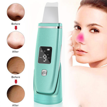 UltraClean Pro 5-in-1 Ultrasonic Blackhead Remover – Facial Cleansing & Skin Lifting Device
