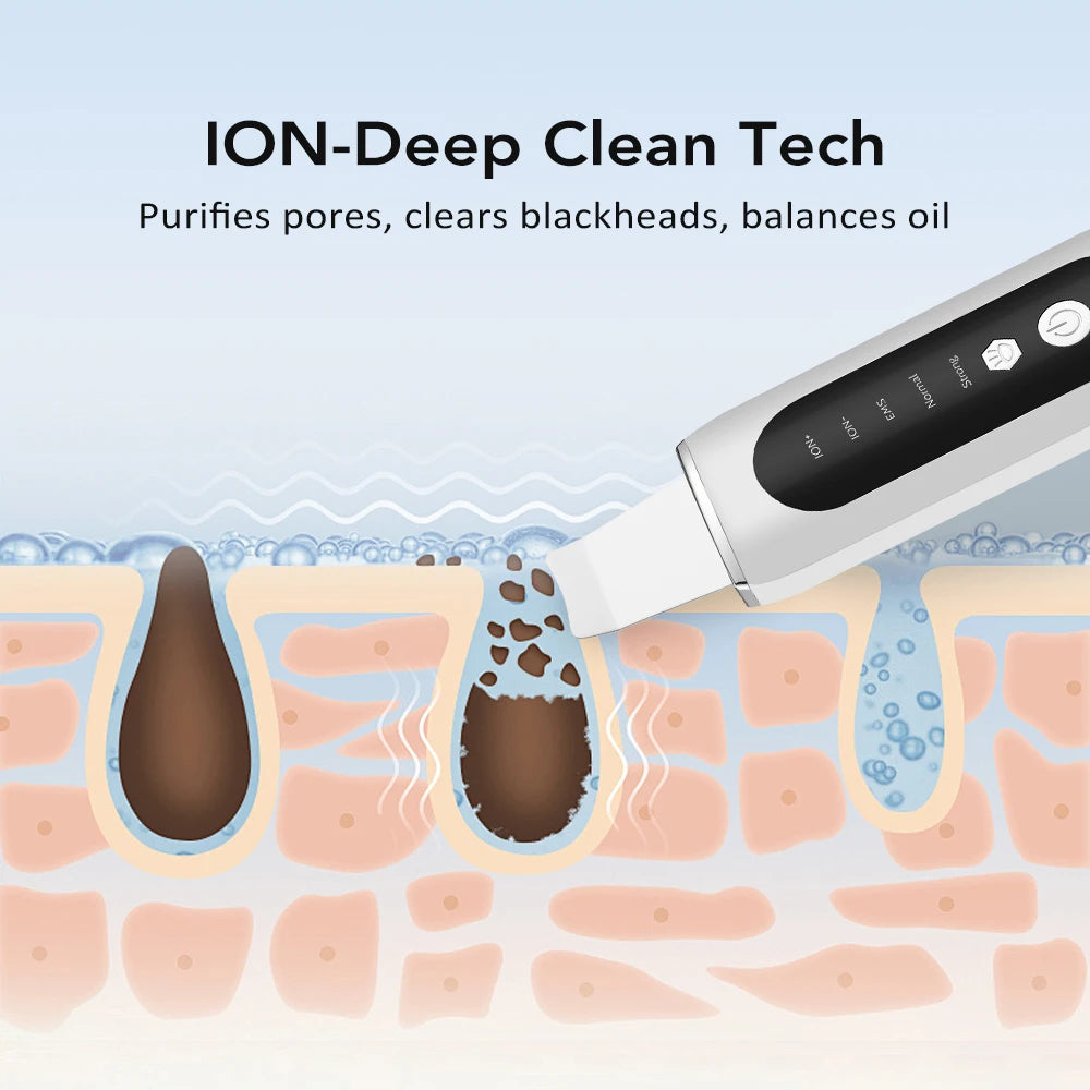 Ultrasonic Skin Scrubber Deep Face Cleaning Acne Blackhead Remover Facial Spatula Peeling Shovel EMS Skin Lifting Machine