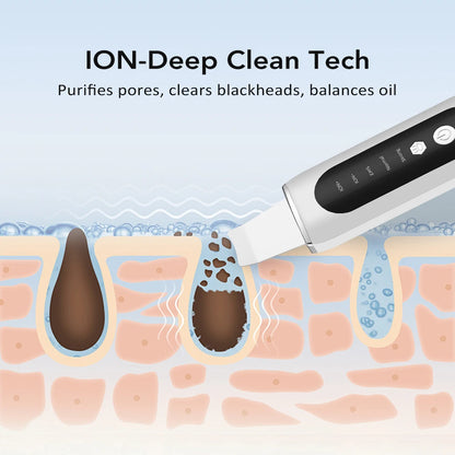 Ultrasonic Skin Scrubber Deep Face Cleaning Acne Blackhead Remover Facial Spatula Peeling Shovel EMS Skin Lifting Machine